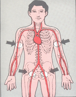 First aid for bleeding : - First aid for internal bleeding | EHC ...