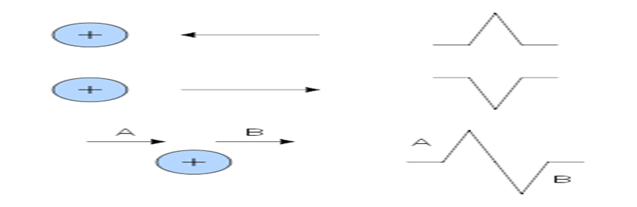 Procedural Work For Electrocardiography : - Electrocardiogram (ECG ...