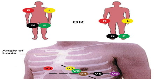 Procedural Work For Electrocardiography : - Electrocardiogram (ECG ...