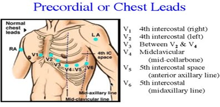 Procedural Work For Electrocardiography : - Electrocardiogram (ECG ...