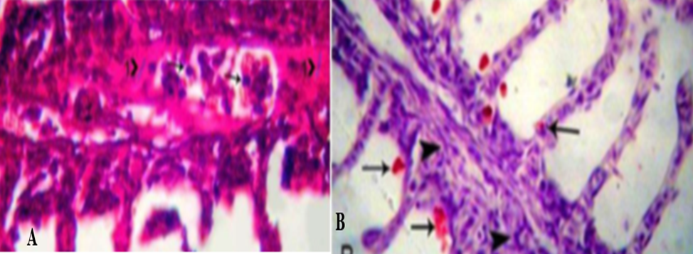 Branchiomycosis (Gill Rot Disease): - Lab Diagnosis | EHC | Egyptian ...